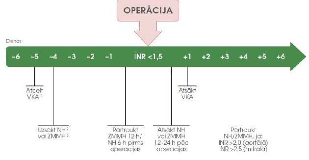 Antikoagulantu atcelšana pirms plānveida invazīvas procedūras pacientam ar sirds vārstuļa protēzi